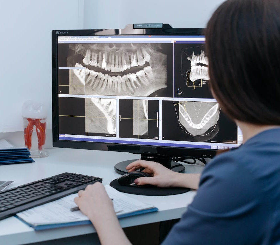 Image of dental x-ray